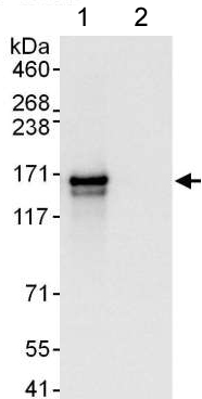 Immunoprecipitation - Anti-LRRFIP1 antibody (AB176587)