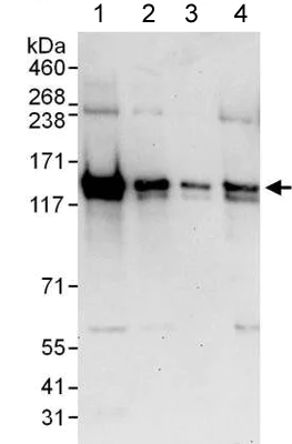 Western blot - Anti-LRRFIP1 antibody (AB176587)