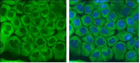 Immunocytochemistry/ Immunofluorescence - Anti-LRRFIP1 antibody (AB229466)