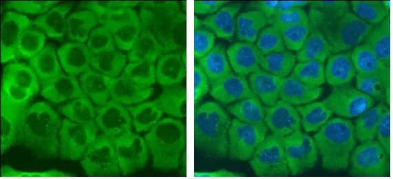 Immunocytochemistry/ Immunofluorescence - Anti-LRRFIP1 antibody (AB229466)