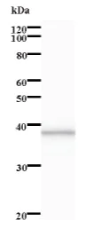 Western blot - Anti-LRRFIP2 antibody [377C3a] (AB84874)