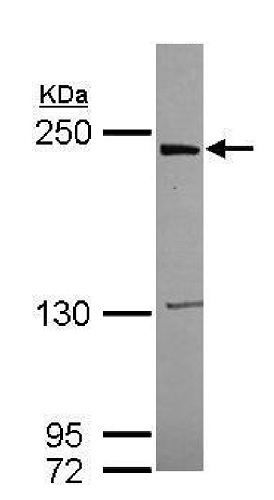 Western blot - Anti-LRRK1 antibody (AB228666), expandable thumbnail