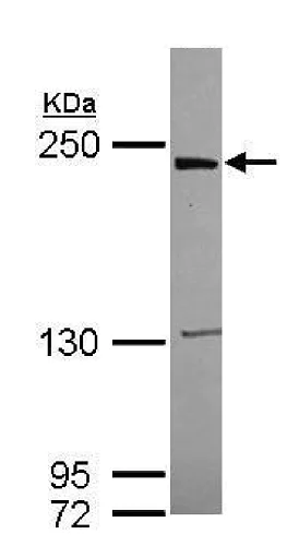 Western blot - Anti-LRRK1 antibody (AB228666)