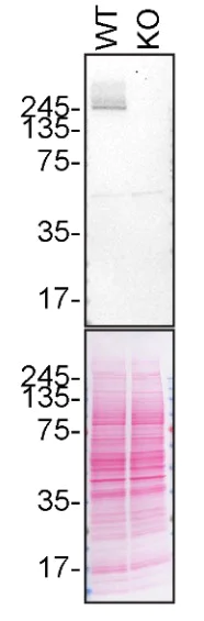 Western blot - Anti-LRRK2 antibody [MJFF2 (c41-2)] (AB133474)
