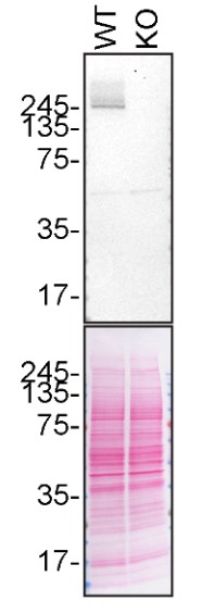 Western blot - Anti-LRRK2 antibody [MJFF2 (c41-2)] - BSA and Azide free (AB172378)