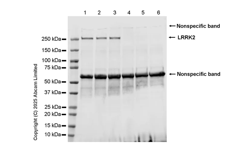 Western blot - Anti-LRRK2 antibody [MJFF2 (c41-2)] - Chicken IgY (Chimeric) (AB325488)