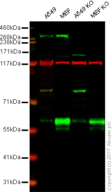 Western blot - Anti-LRRK2 antibody [MJFF3 (c69-6)] (AB133475)