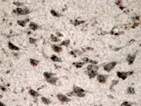 Immunohistochemistry (Formalin/PFA-fixed paraffin-embedded sections) - Anti-LRRK2 antibody [MJFF3 (c69-6)] - BSA and Azide free (AB183216)