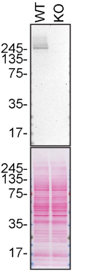 Western blot - Anti-LRRK2 antibody [MJFF3 (c69-6)] - BSA and Azide free (AB183216), expandable thumbnail