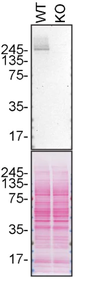 Western blot - Anti-LRRK2 antibody [MJFF3 (c69-6)] - BSA and Azide free (AB183216)