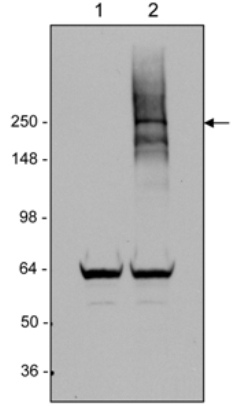 Western blot - Anti-LRRK2 antibody [MJFF4 (c81-8)] (AB133476), expandable thumbnail