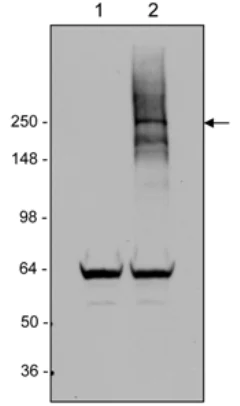 Western blot - Anti-LRRK2 antibody [MJFF4 (c81-8)] (AB133476)