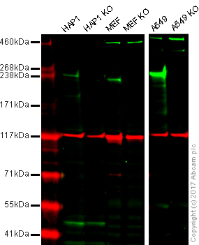 Western blot - Anti-LRRK2 antibody [MJFF4 (c81-8)] - BSA and Azide free (AB256587)