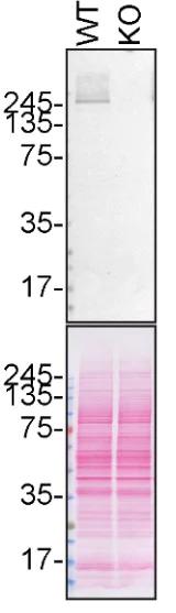 Western blot - Anti-LRRK2 antibody [MJFF4 (c81-8)] - BSA and Azide free (AB256587)