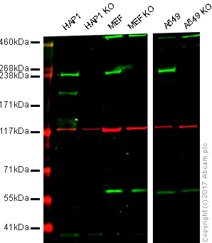 Western blot - Anti-LRRK2 antibody [MJFF5 (68-7)] (AB181386)