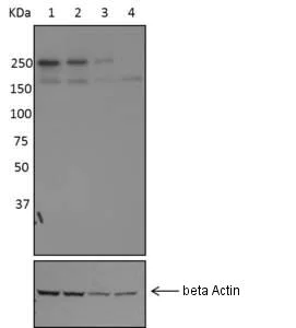 Western blot - Anti-LRRK2 antibody [MJFF5 (68-7)] (AB181386)