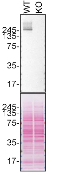 Western blot - Anti-LRRK2 antibody [MJFF5 (68-7)] (AB181386)