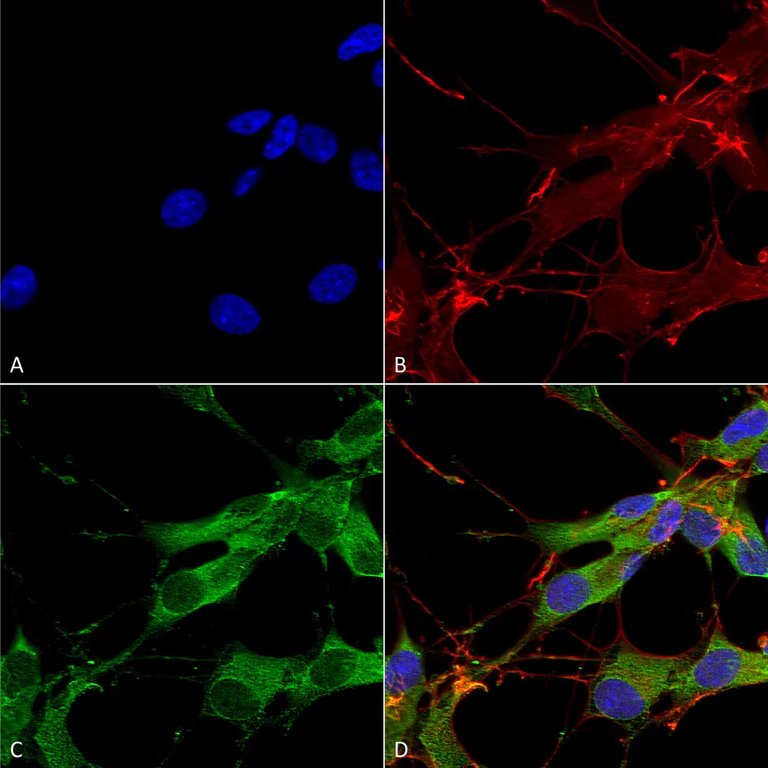 Immunocytochemistry/ Immunofluorescence - Anti-LRRK2 antibody [N138/6] - N-terminal (AB186334)
