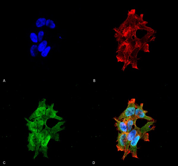 Immunocytochemistry/ Immunofluorescence - Anti-LRRK2 antibody [N138/6] - N-terminal (AB186334)