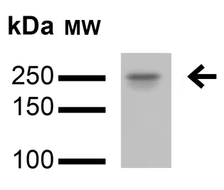 Western blot - Anti-LRRK2 antibody [N138/6] - N-terminal (AB186334)