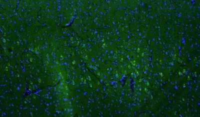 Immunohistochemistry (Formalin/PFA-fixed paraffin-embedded sections) - Anti-LRRK2 antibody [N241A/34] - Chicken IgY (Chimeric) (AB325673)