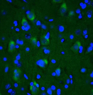 Immunohistochemistry (Formalin/PFA-fixed paraffin-embedded sections) - Anti-LRRK2 antibody [N241A/34] - Chicken IgY (Chimeric) (AB325673)