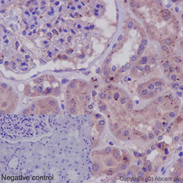 Immunohistochemistry (Formalin/PFA-fixed paraffin-embedded sections) - LRRK2 Antibody Sampler Panel (AB263464), expandable thumbnail