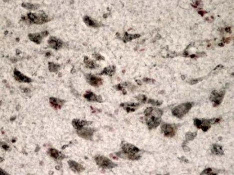 Immunohistochemistry (Formalin/PFA-fixed paraffin-embedded sections) - LRRK2 Antibody Sampler Panel (AB263464), expandable thumbnail