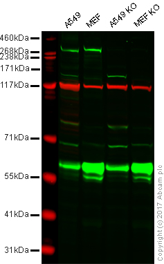 Western blot - LRRK2 Antibody Sampler Panel (AB263464), expandable thumbnail