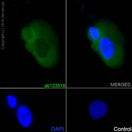 Immunocytochemistry/ Immunofluorescence - Anti-LRRK2 antibody [UDD3 30(12)] (AB133518)