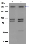 Western blot - Anti-LRRK2 antibody [UDD3 30(12)] (AB133518)