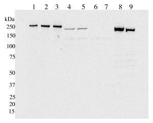 Western blot - Anti-LRRK2 antibody [UDD3 30(12)] (AB133518)