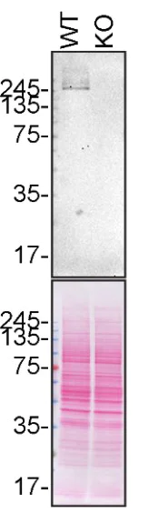 Western blot - Anti-LRRK2 antibody [UDD3 30(12)] (AB133518)
