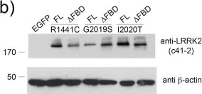 Western blot - Anti-LRRK2 antibody [UDD3 30(12)] (AB133518)