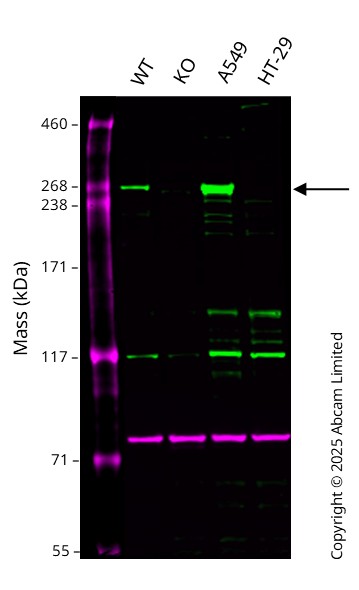 Western blot - Anti-LRRK2 antibody [UDD3 30(12)] (AB133518)