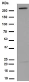 Western blot - Anti-LRRK2 antibody [UDD3 30(12)] (AB133518)