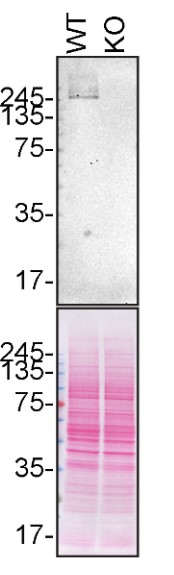 Western blot - Anti-LRRK2 antibody [UDD3 30(12)] - BSA and Azide free (AB170993), expandable thumbnail