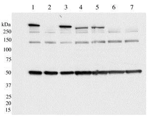 Western blot - Anti-LRRK2 (phospho S910) antibody [UDD1 15(3)] (AB133449)