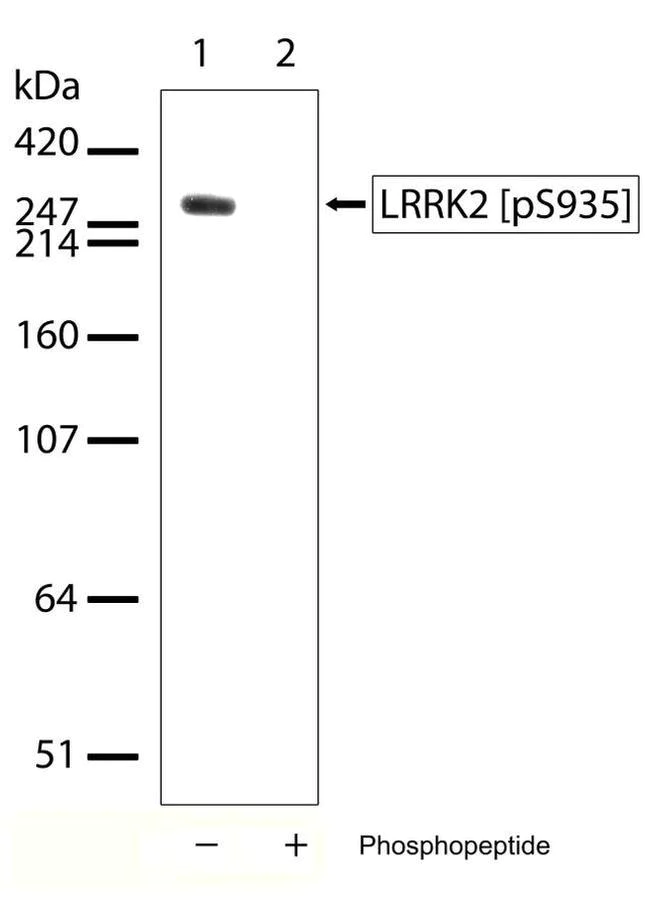 Western blot - Anti-LRRK2 (phospho S935) antibody [RP23040014] (AB307984)