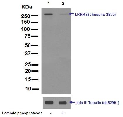 Western blot - Anti-LRRK2 (phospho S935) antibody [UDD2 10(12)] (AB133450), expandable thumbnail