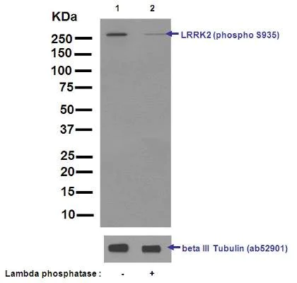 Western blot - Anti-LRRK2 (phospho S935) antibody [UDD2 10(12)] (AB133450)