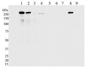 Western blot - Anti-LRRK2 (phospho S935) antibody [UDD2 10(12)] (AB133450), expandable thumbnail