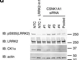Western blot - Anti-LRRK2 (phospho S935) antibody [UDD2 10(12)] (AB133450)