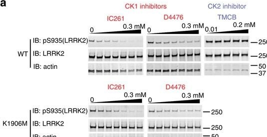 Western blot - Anti-LRRK2 (phospho S935) antibody [UDD2 10(12)] (AB133450)