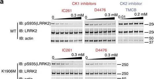 Western blot - Anti-LRRK2 (phospho S935) antibody [UDD2 10(12)] (AB133450)