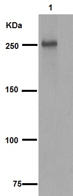 Western blot - Anti-LRRK2 (phospho S935) antibody [UDD2 10(12)] (AB133450), expandable thumbnail