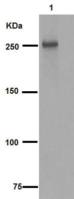 Western blot - Anti-LRRK2 (phospho S935) antibody [UDD2 10(12)] (AB133450)