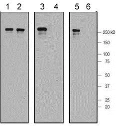 Western blot - Anti-LRRK2 (phospho S955) antibody [MJF-R11 (75-1)] - BSA and Azide free (AB172380)