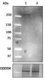 Western blot - Anti-LRRK2 (phospho T1410) antibody [MJFR4-25-5] - BSA and Azide free (AB248886)