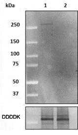 Western blot - Anti-LRRK2 (phospho T1410) antibody [MJFR4-25-5] - BSA and Azide free (AB248886)